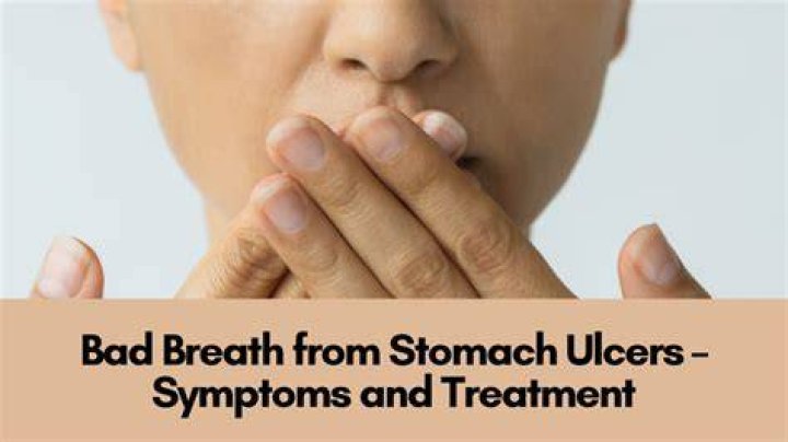 Do ulcers cause bad breath?