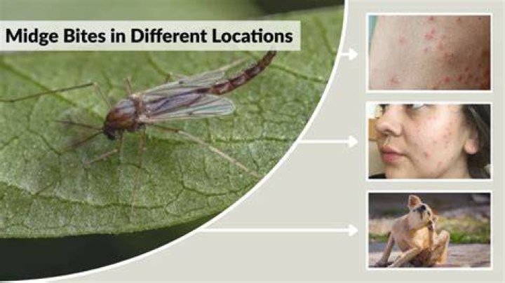 Does a midge bite?