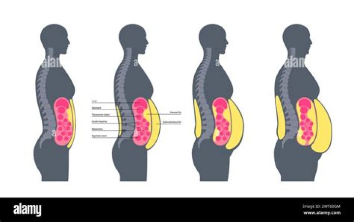 How is stomach fat formed?