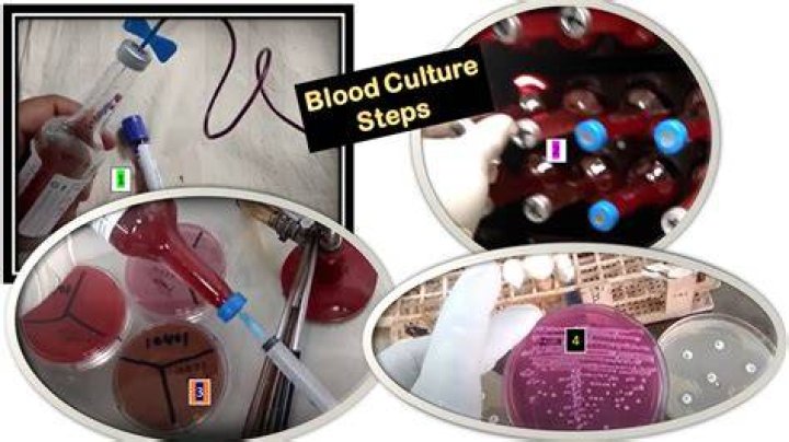 How to take hemoculture?