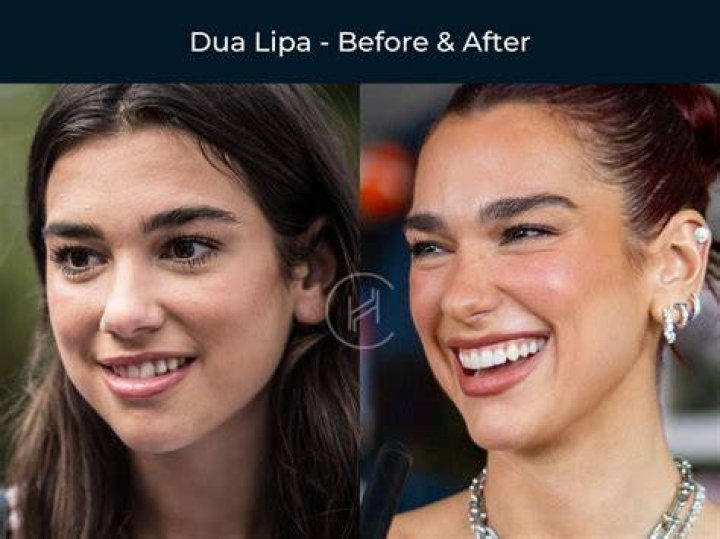 Who has a gap in their teeth?