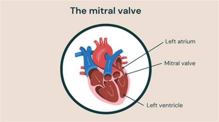 Who is a mitral valve?
